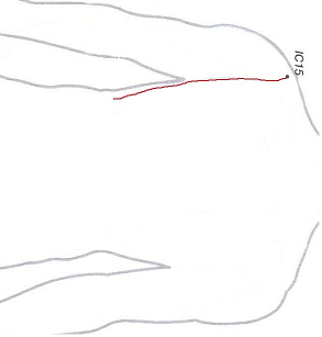 Foto 11a