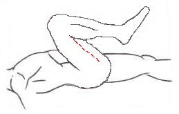 Foto 32b