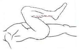 Foto 32c