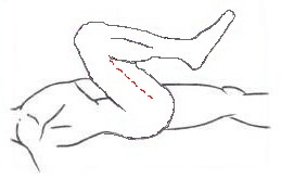 Foto 34b