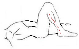 Foto 34c
