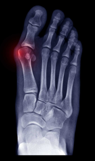 Radiografia
