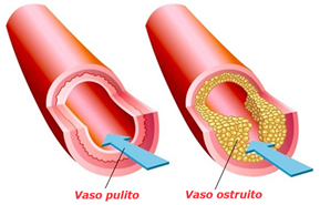 Vasi puliti