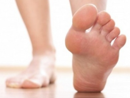 Piedi piatti 1