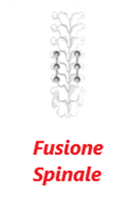 Fusione spinale