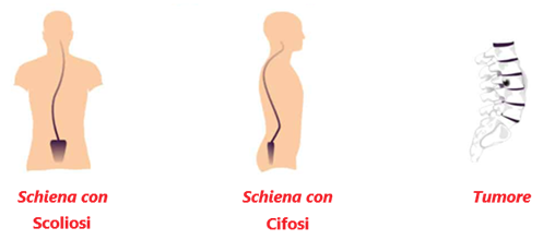 Indebolimento