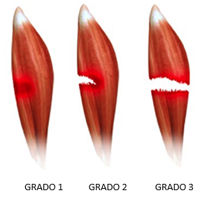 Lesioni in gradi