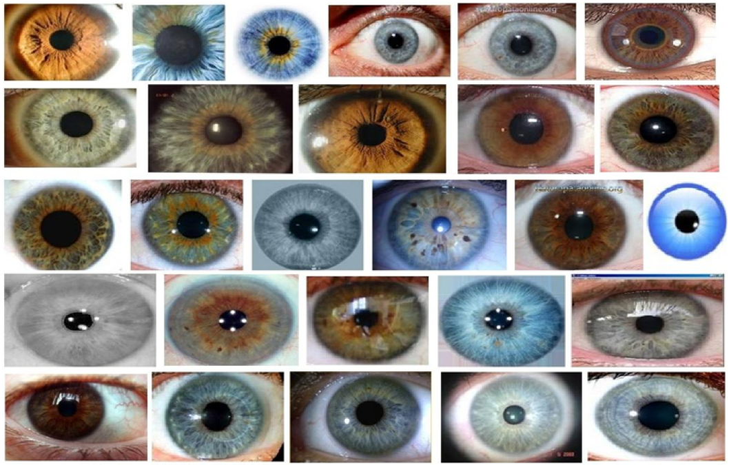 iridologia